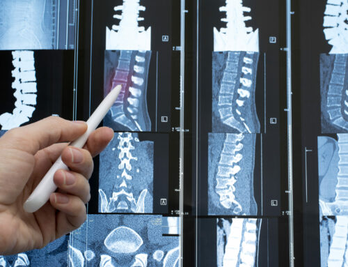 EL GEER LIDERA EL PRIMER CONSENSO NACIONAL PARA UNIFICAR EL MANEJO DE LA FRACTURA VERTEBRAL OSTEOPORÓTICA