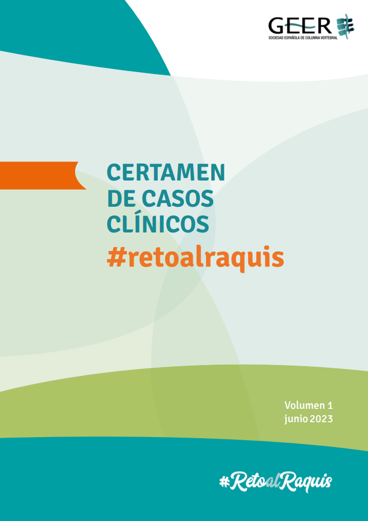 Reto al Raquis | Volumen 1 – Junio 2023