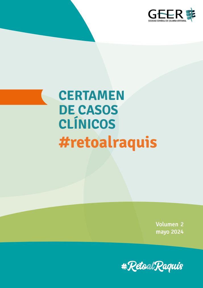 Reto al Raquis | Volumen 2 - Mayo 2024